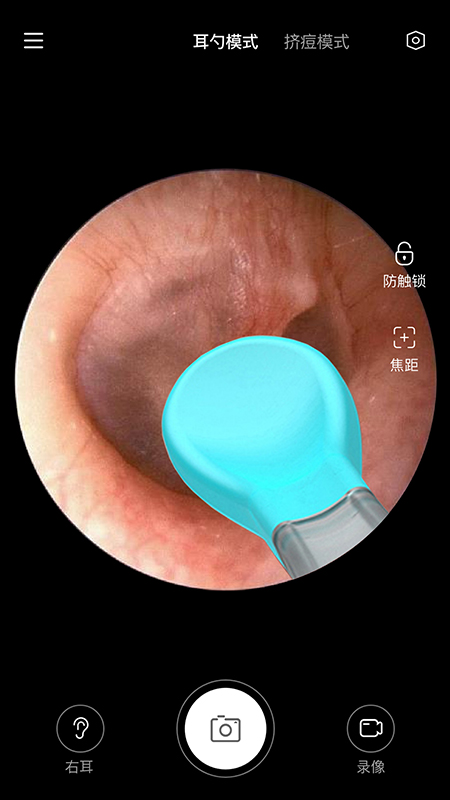 xlife���Ӷ��װ�װ����v1.0.60 �ֻ���